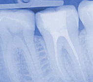 Zahnarztpraxis Schröck Foto Endodontologie